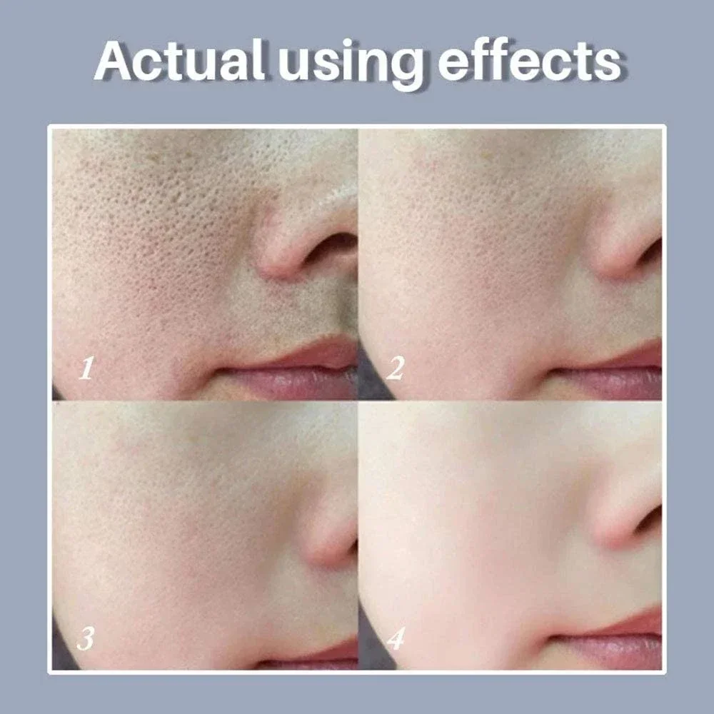 Skin Texture | Pore Refining Resurfacing, Brightening Facial Serum with Retinol and Niacinamide Non-Comedogenic - Image 4